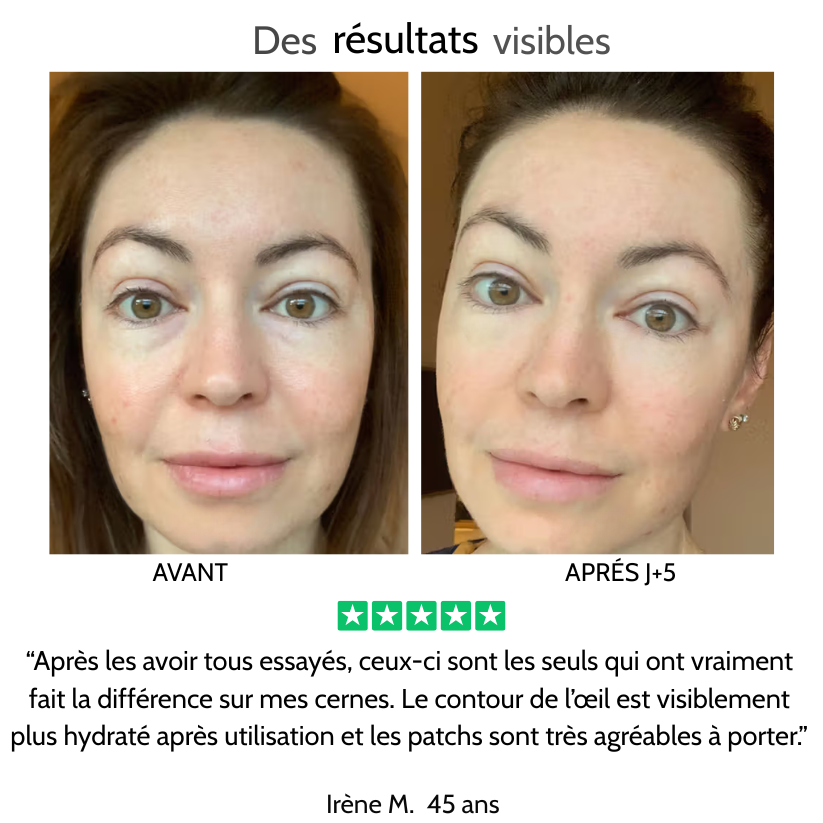 Patchs hydrogel contour des yeux – caféine