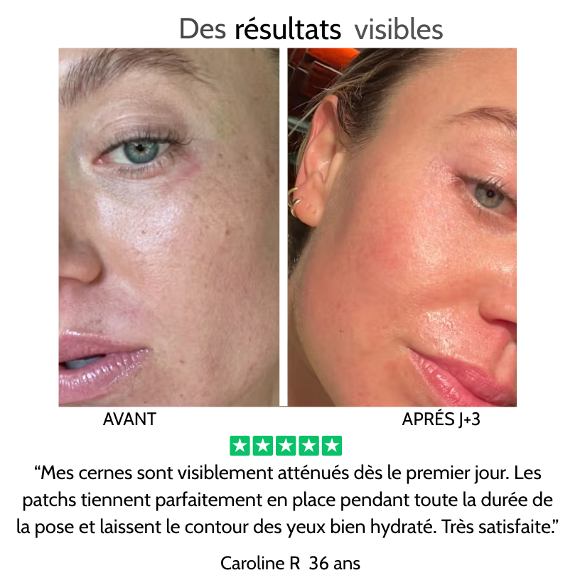 Patchs Défatigants Regard – Extrait de Thé