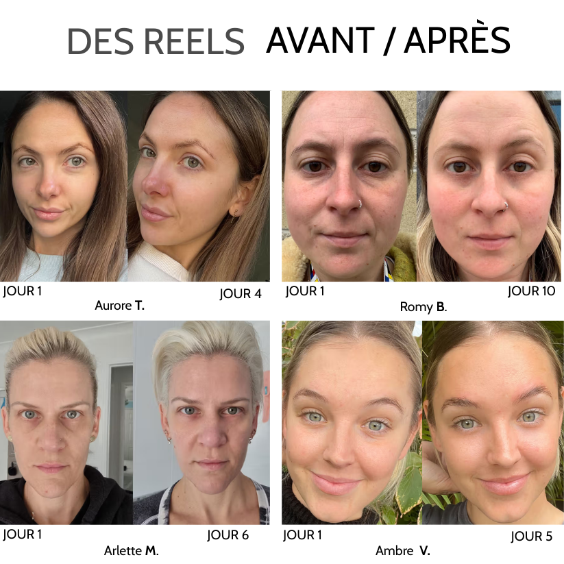 Patchs hydrogel contour des yeux – caféine