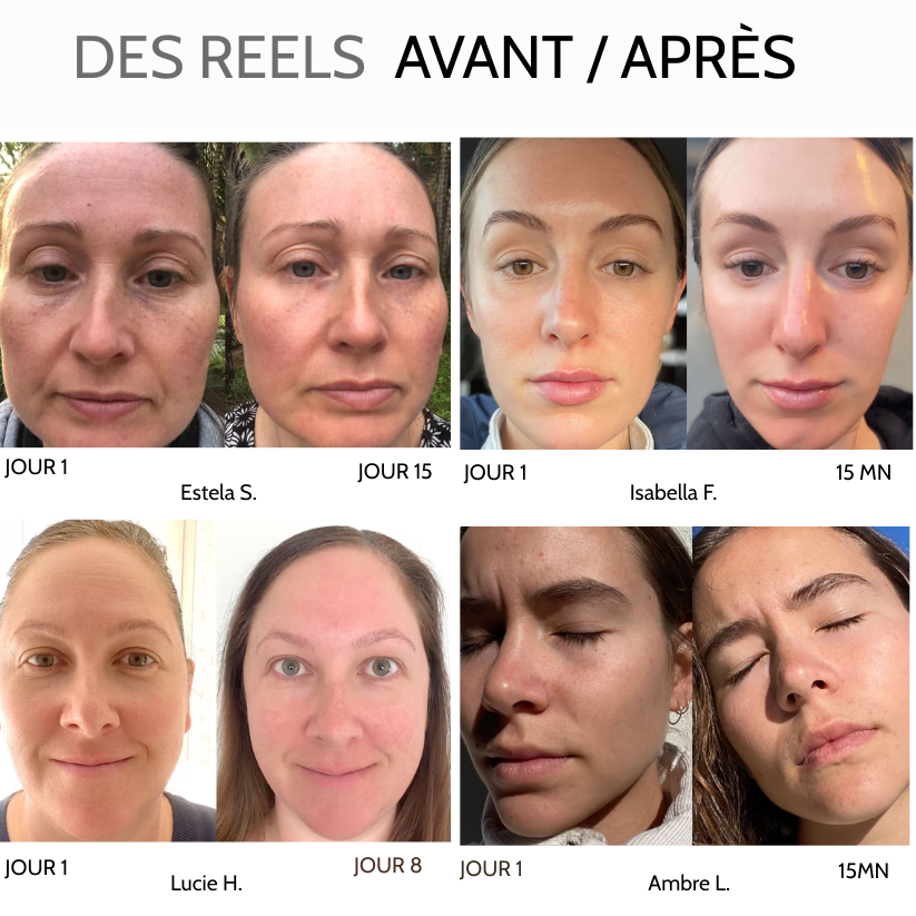 Patchs Défatigants Regard – Extrait de Thé